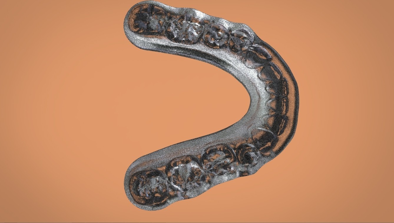 STL file Digital Mandibular Tanner Splint 🦷・3D printer model to ...