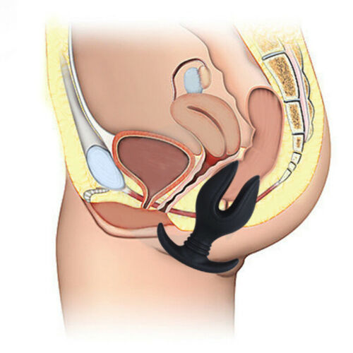 how does anal plug work What is the Purpose of a Butt Plug & What Does it Do? main image 1