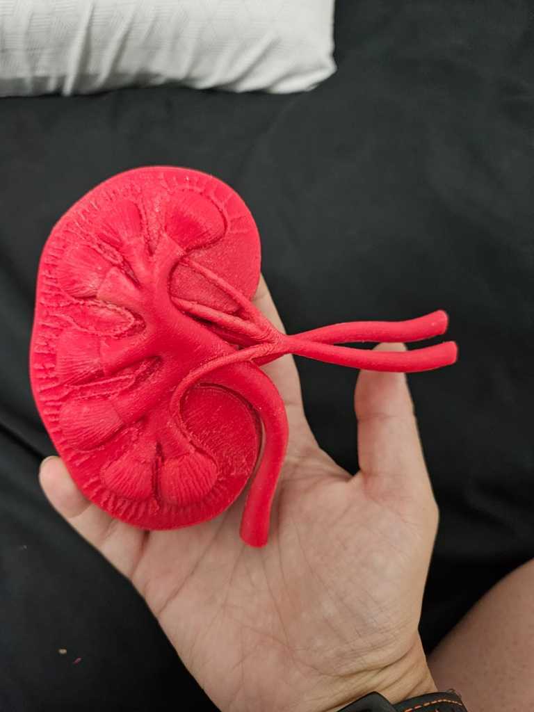 🧪 Riñón todo junto・Archivo 3D Gratis para ・Cults