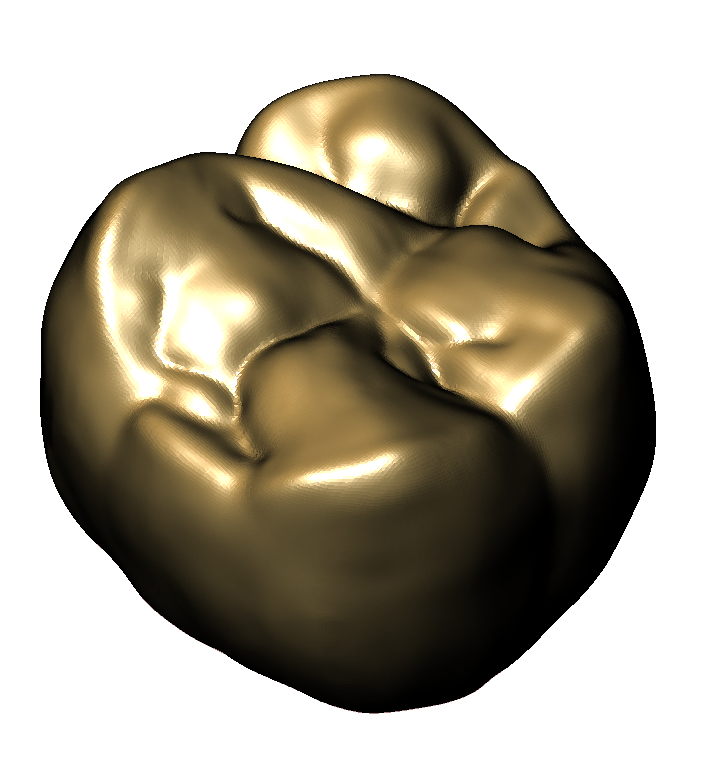 👑 Maxillary Molar 1・Free STL File for ・Cults